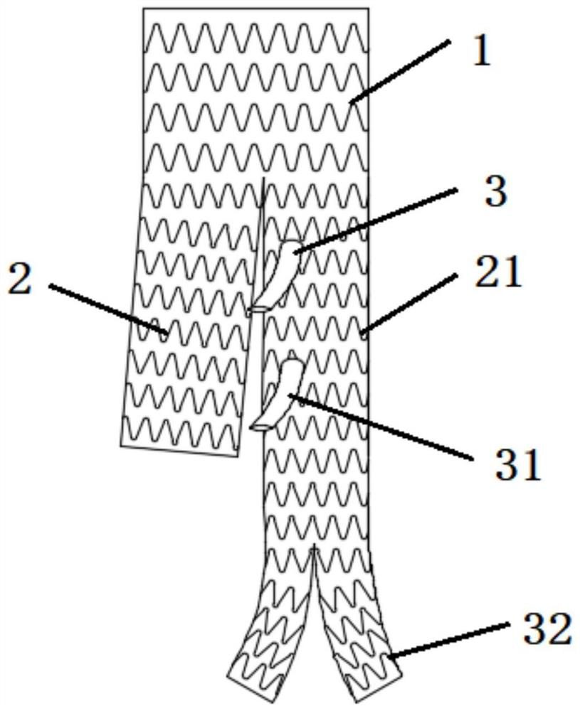 Stent graft suitable for thoracic and abdominal aorta