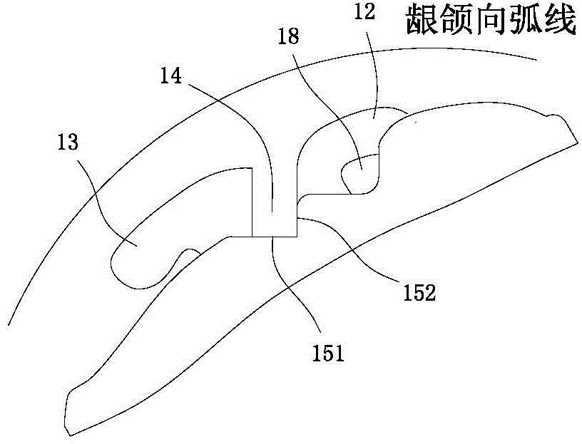 Customized tongue side orthodontic bracket and manufacturing method thereof