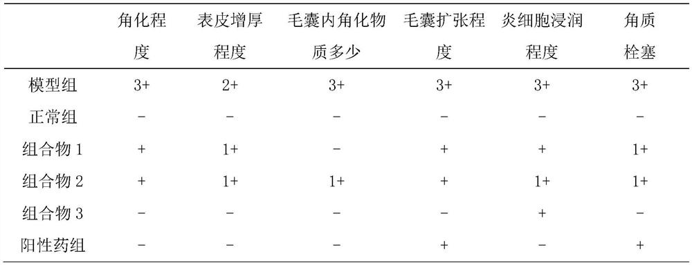 Composition for whitening, acne removal, blackhead removal and anti-aging and its use and preparation