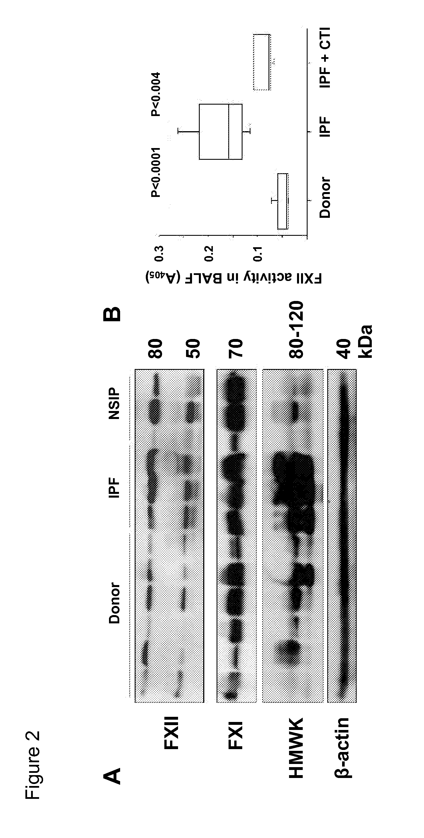 Factor xii inhibitors for treating interstitial lung disease