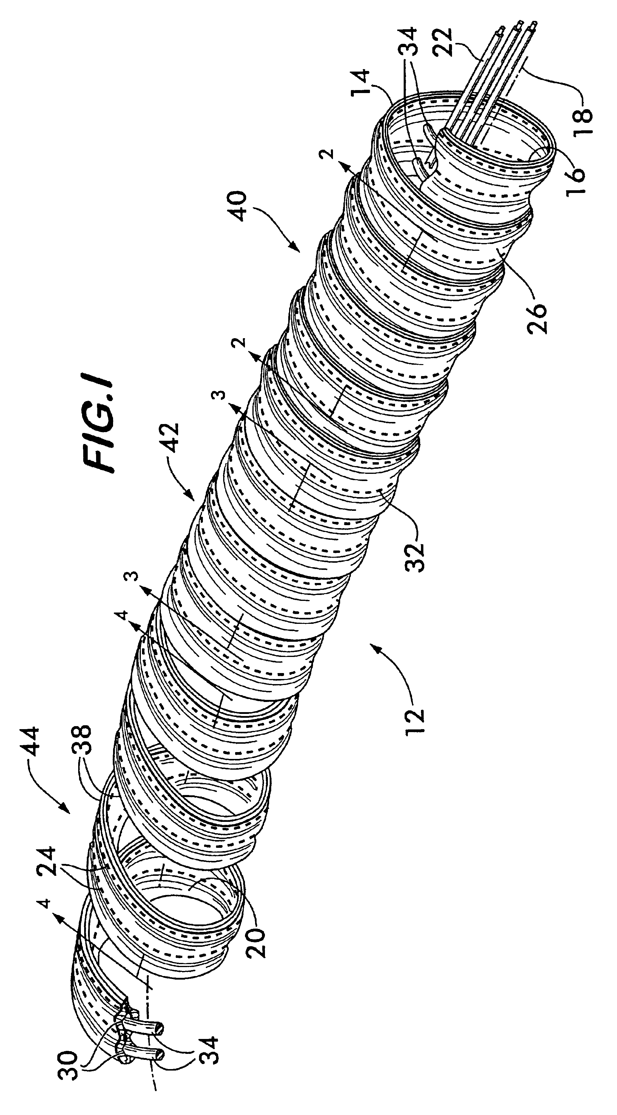 Damping sleeve with resilient support members