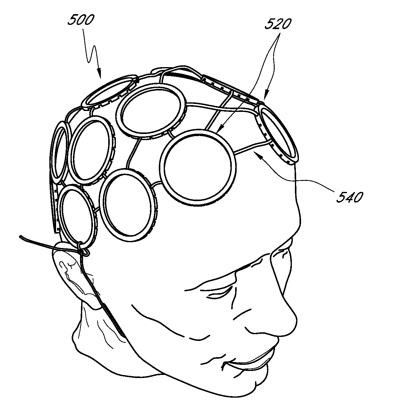 Apparatus and method for indicating treatment site locations for phototherapy to the brain