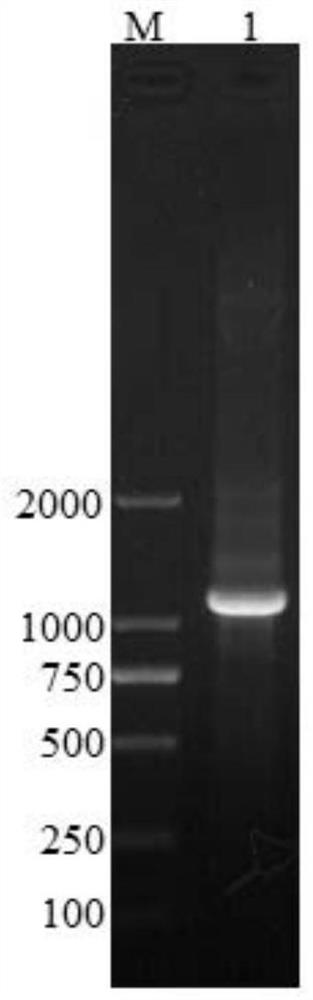 Recombinant human follicle-stimulating hormone and its preparation method