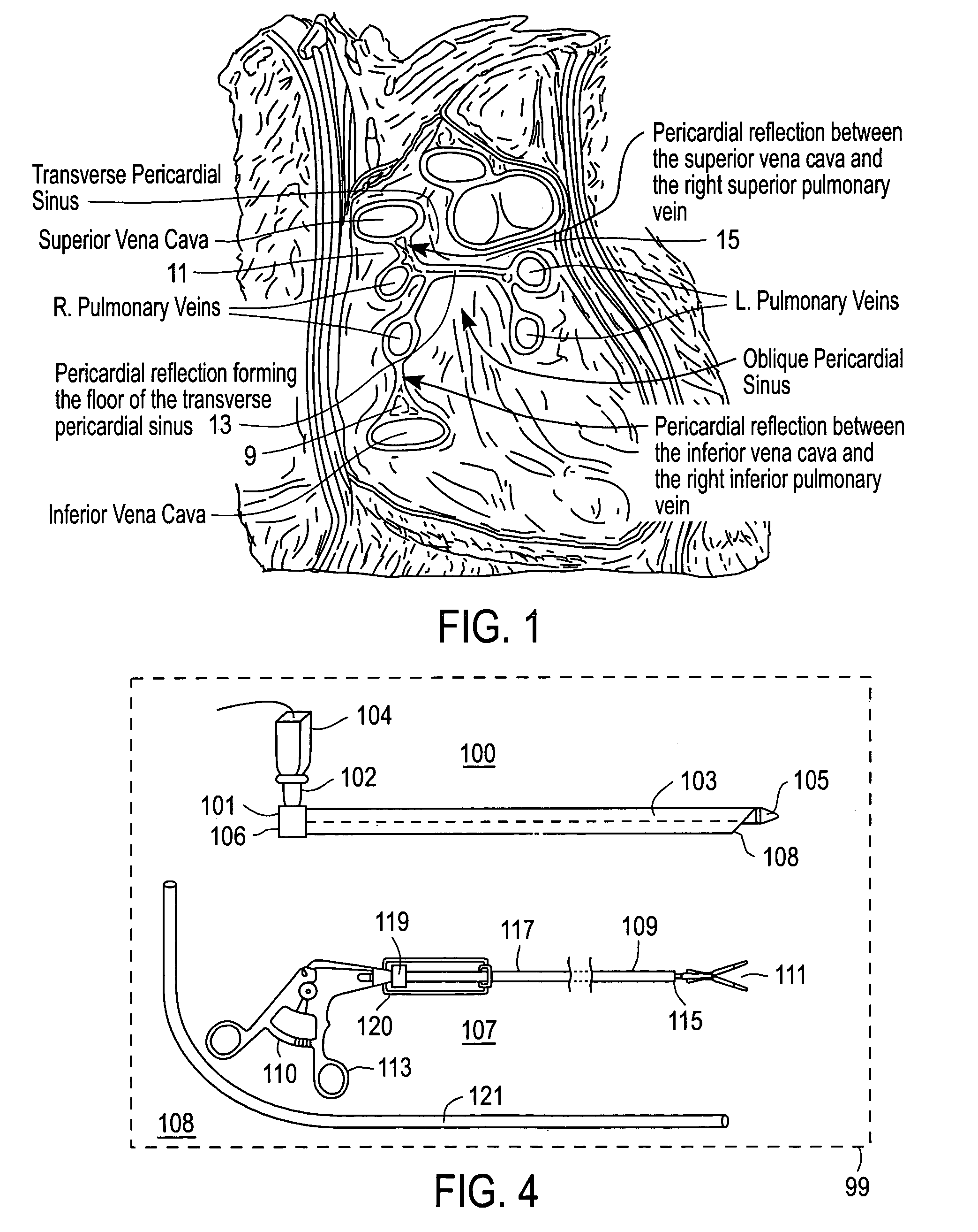 Apparatus and method for endoscopic encirclement of pulmonary veins for epicardial ablation