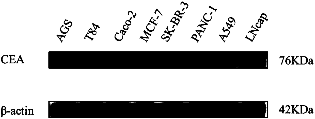 Double-target CAR-T therapy vector for colon cancer, and construction method and application of double-target CAR-T therapy vector