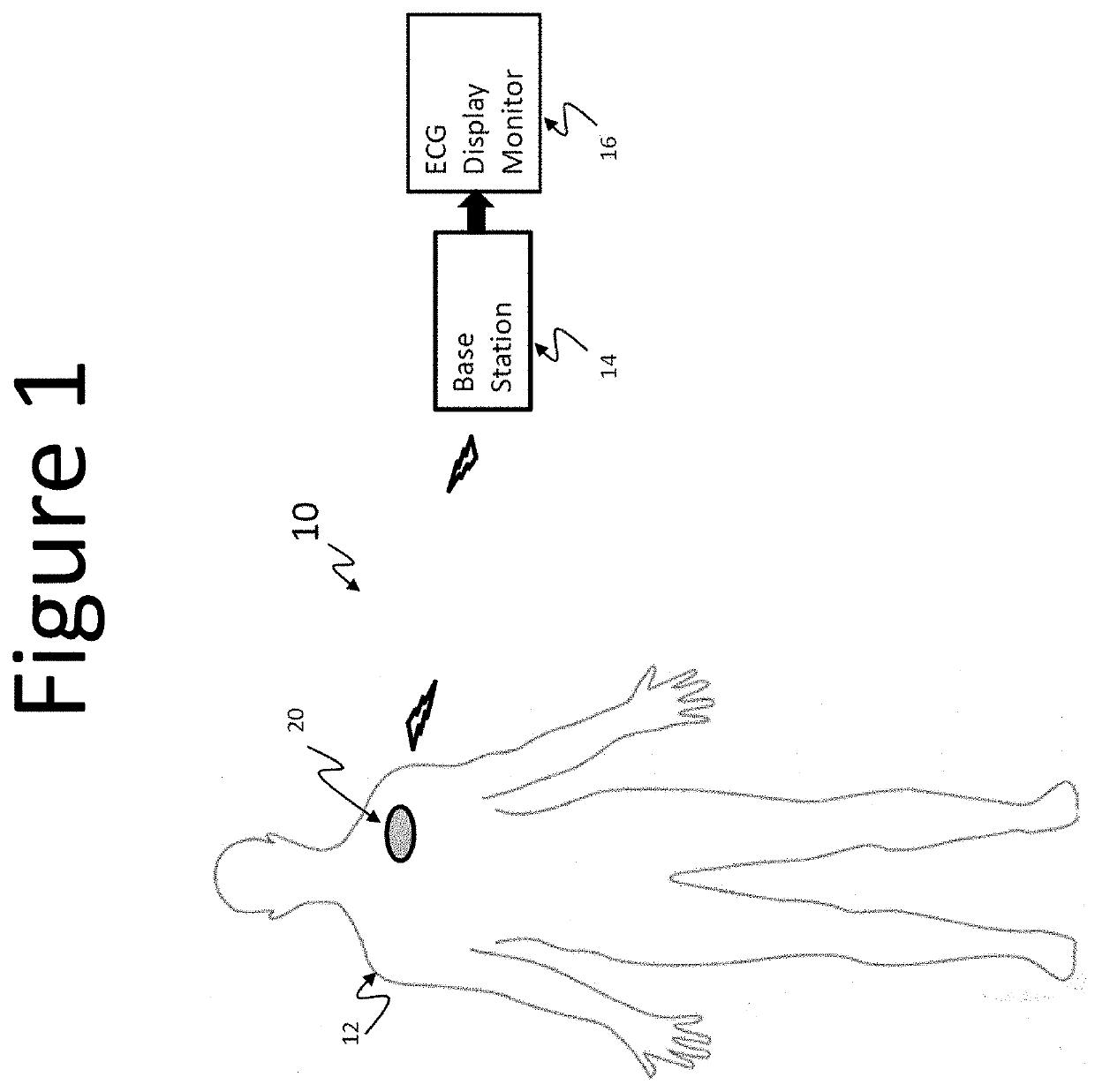 Electric biopotential signal mapping calibration, estimation, source separation, source localization, stimulation, and neutralization.