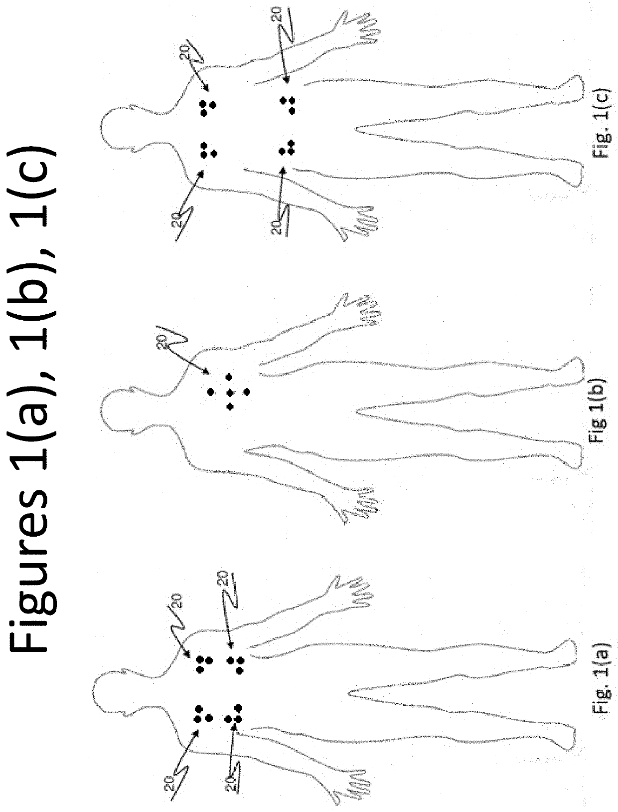 Electric biopotential signal mapping calibration, estimation, source separation, source localization, stimulation, and neutralization.