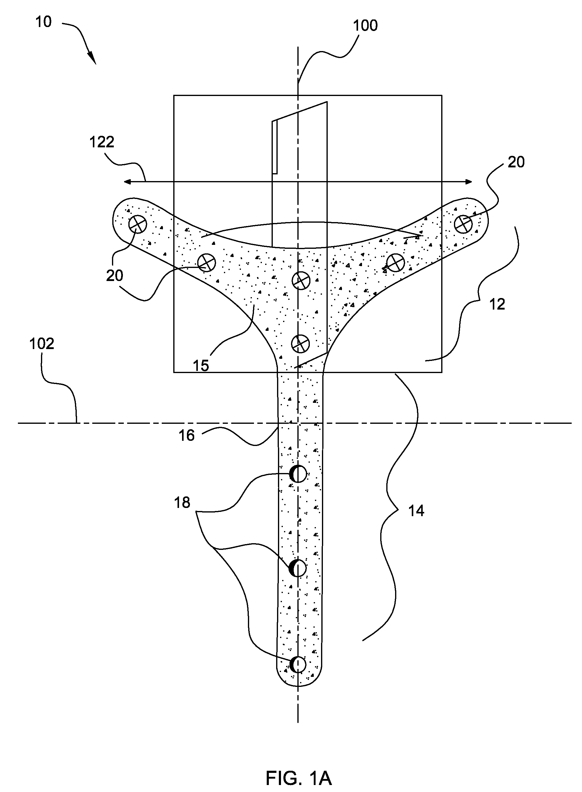 Temporal Brow Lifting and Fixation Device