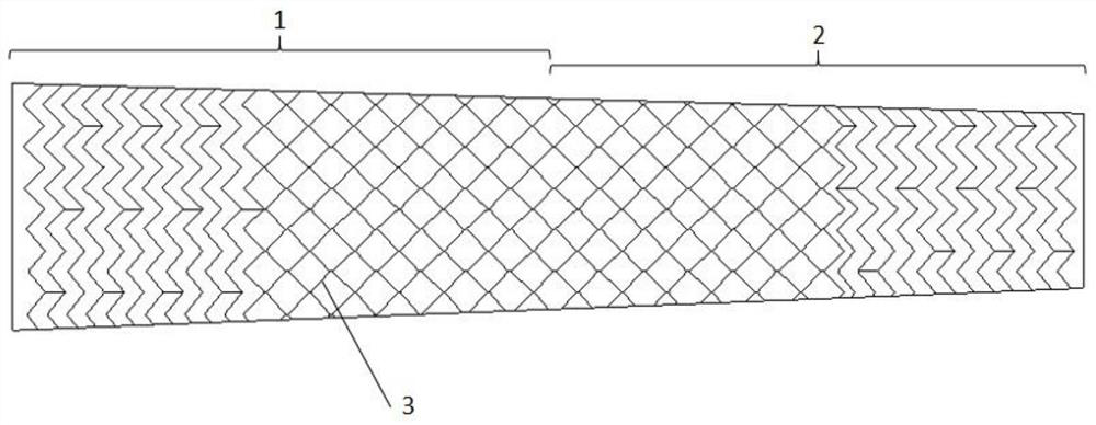 Intravascular stent applied to carotid artery