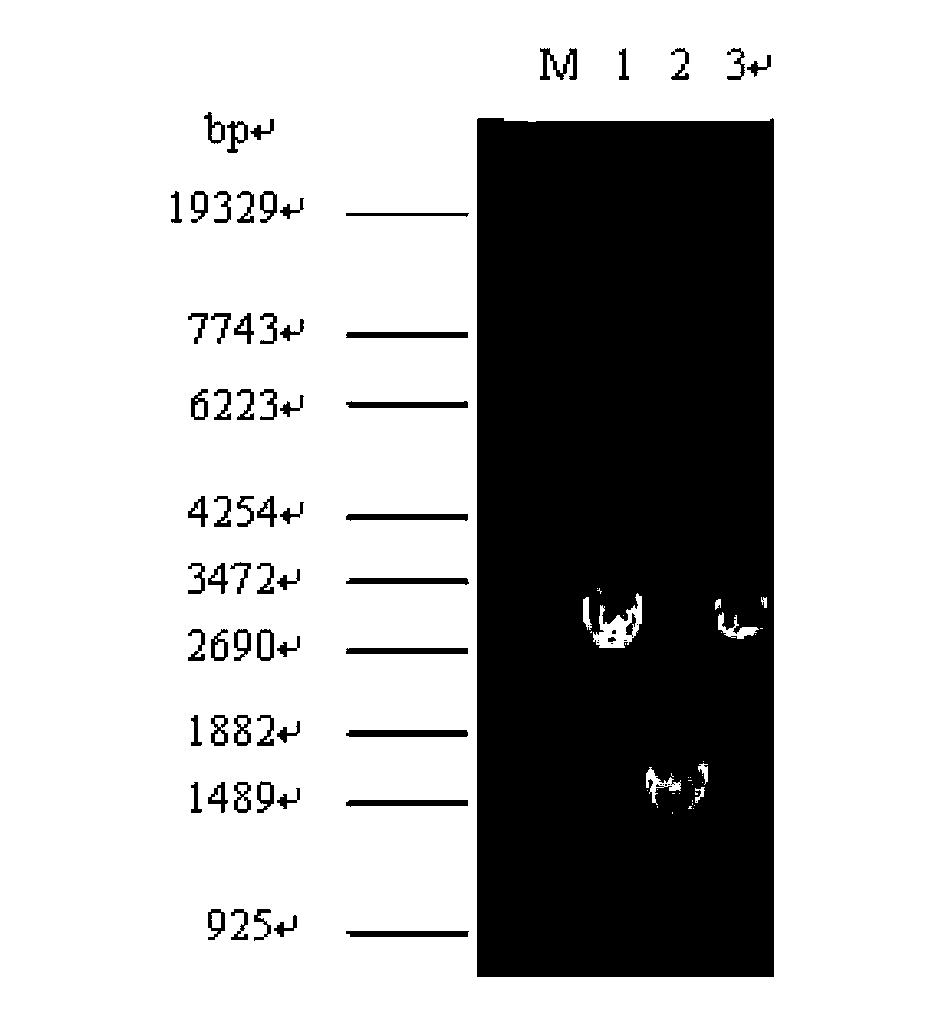 Succinic acid genetic engineering bacterium and method for fermenting and producing succinic acid