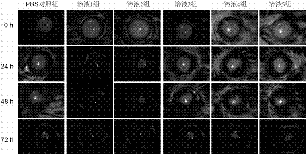 Dihydromyricetin eye drop with synergistic effect and high aqueous solution stability and preparation method thereof