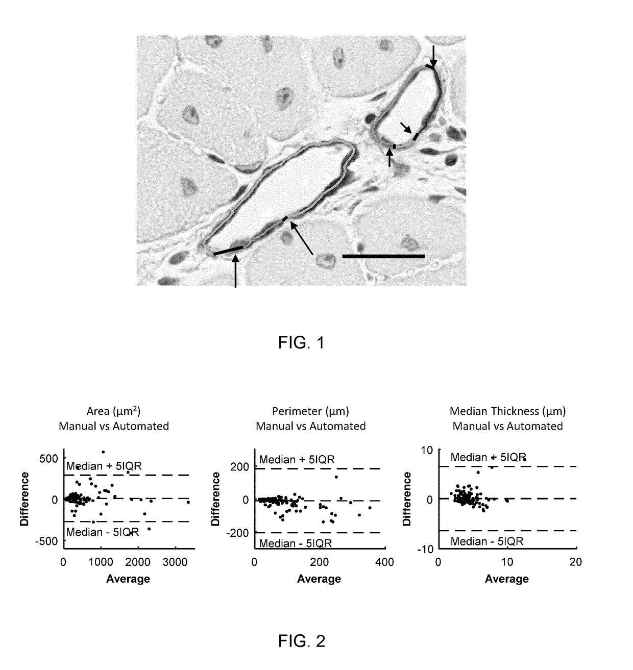 Automated segmentation of histological sections for vasculature quantification