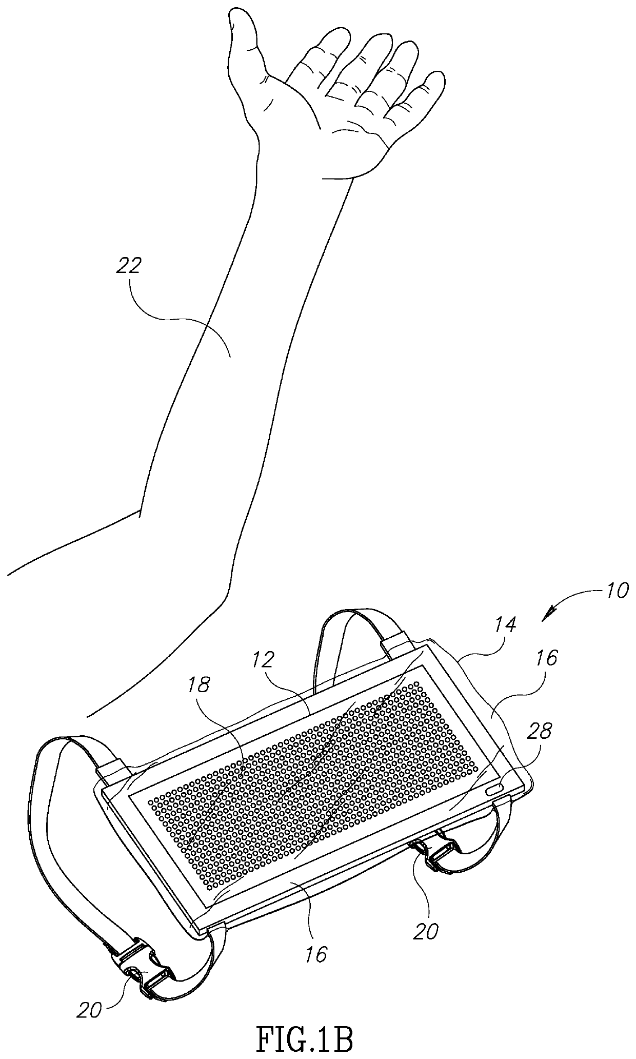 Compositions, devices, systems, kits and methods for the treatment of a skin condition