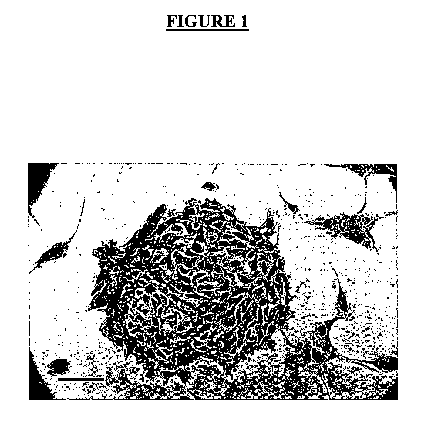 Method of the discrimination and isolation of mammary epithelial stem and colony-forming cells