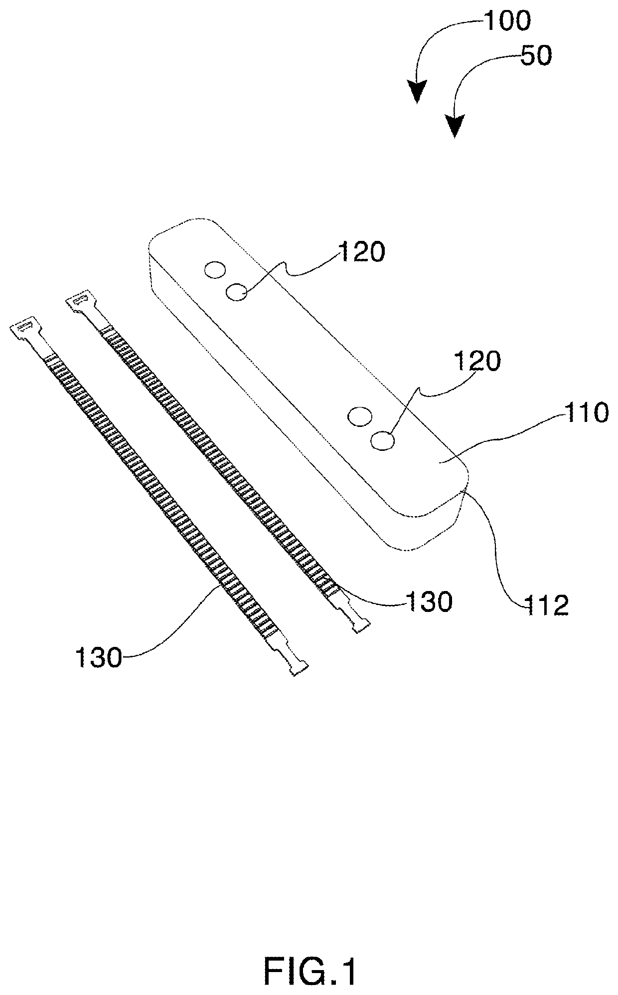 Handle attachment systems and method