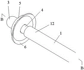 Special-shaped balloon ureteral calculi blocking extractor