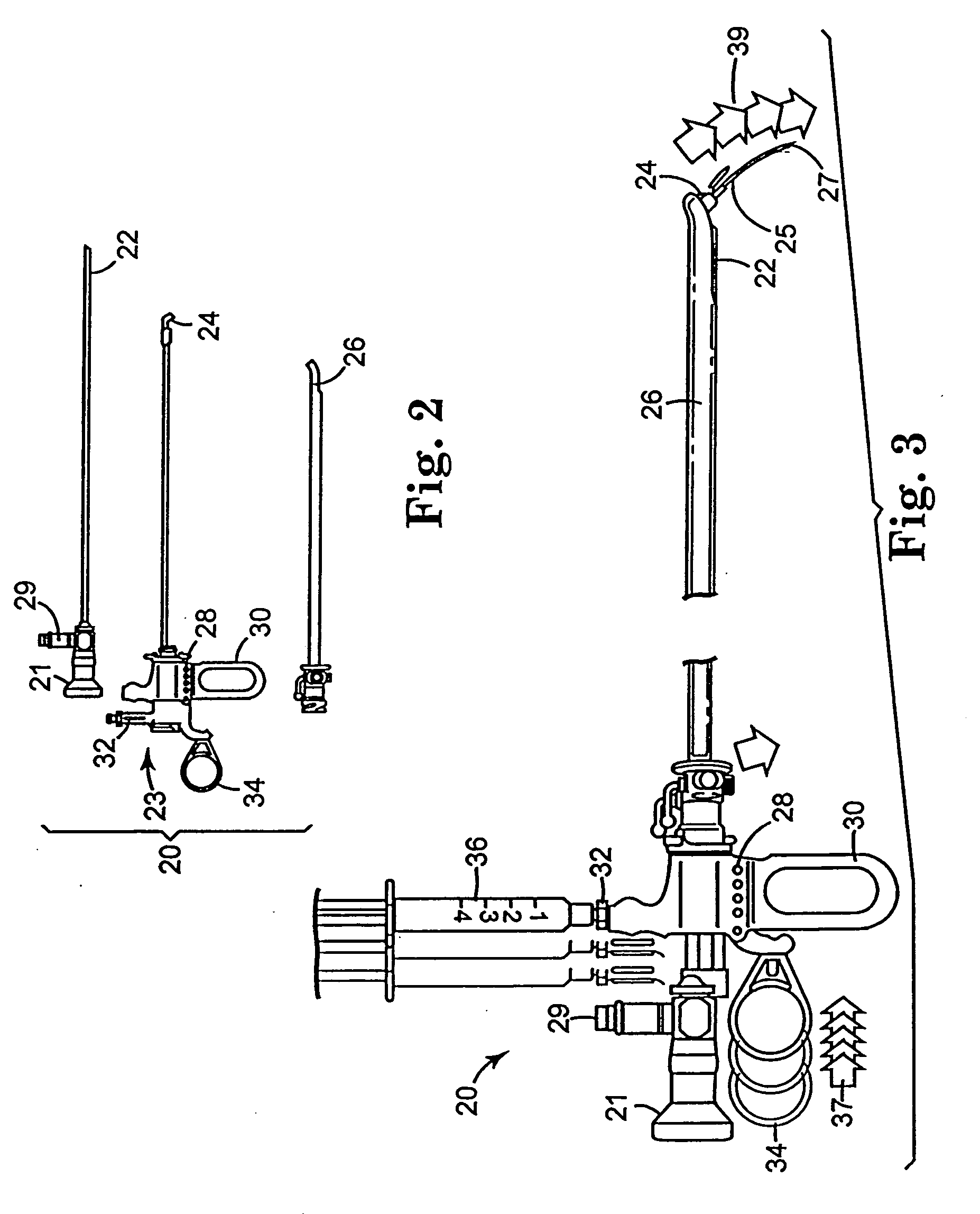 Regimen for treating prostate tissue and surgical kit for use in the regimen