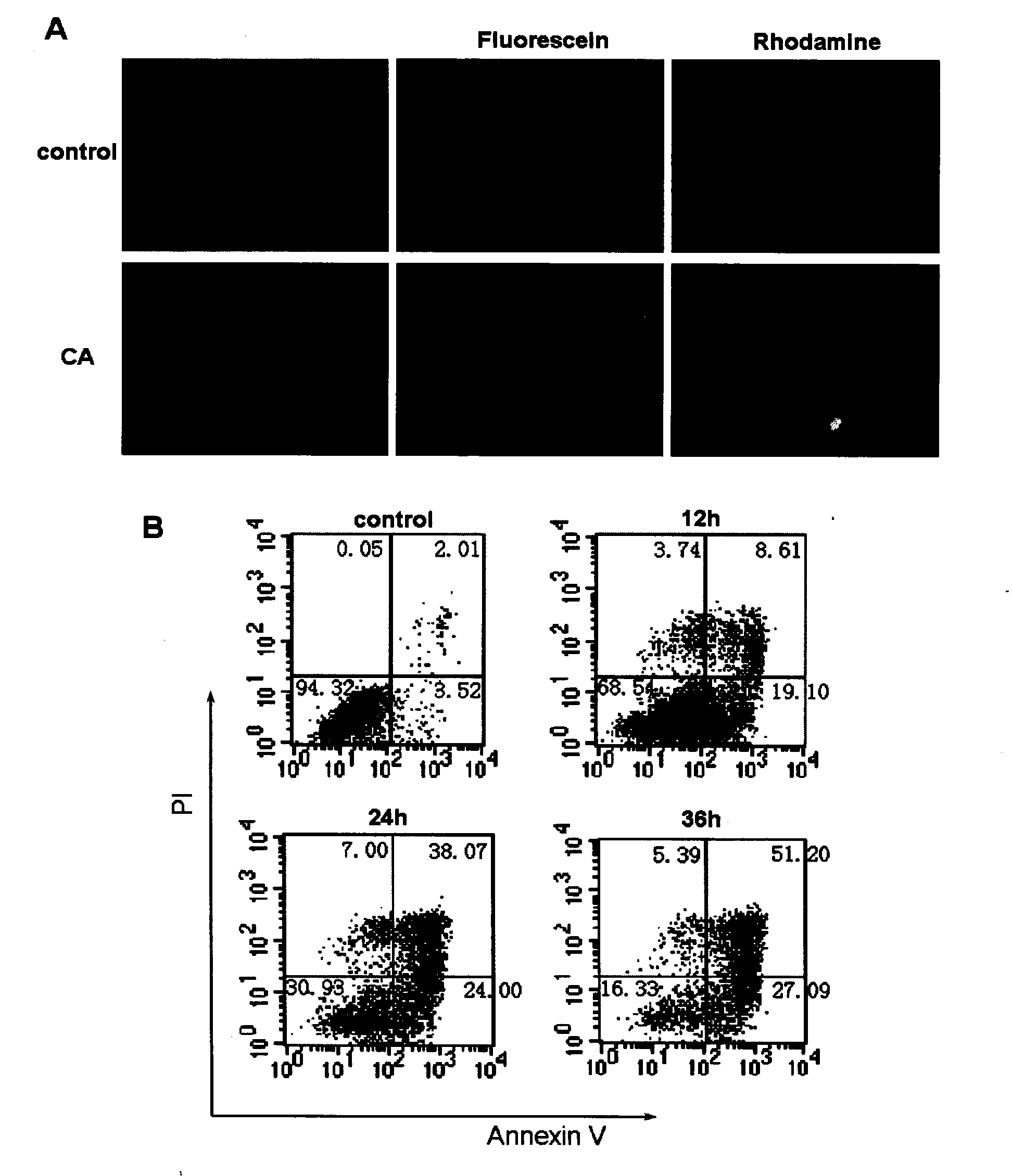 Application of corosolic acid in preparation of antineoplastic medicine