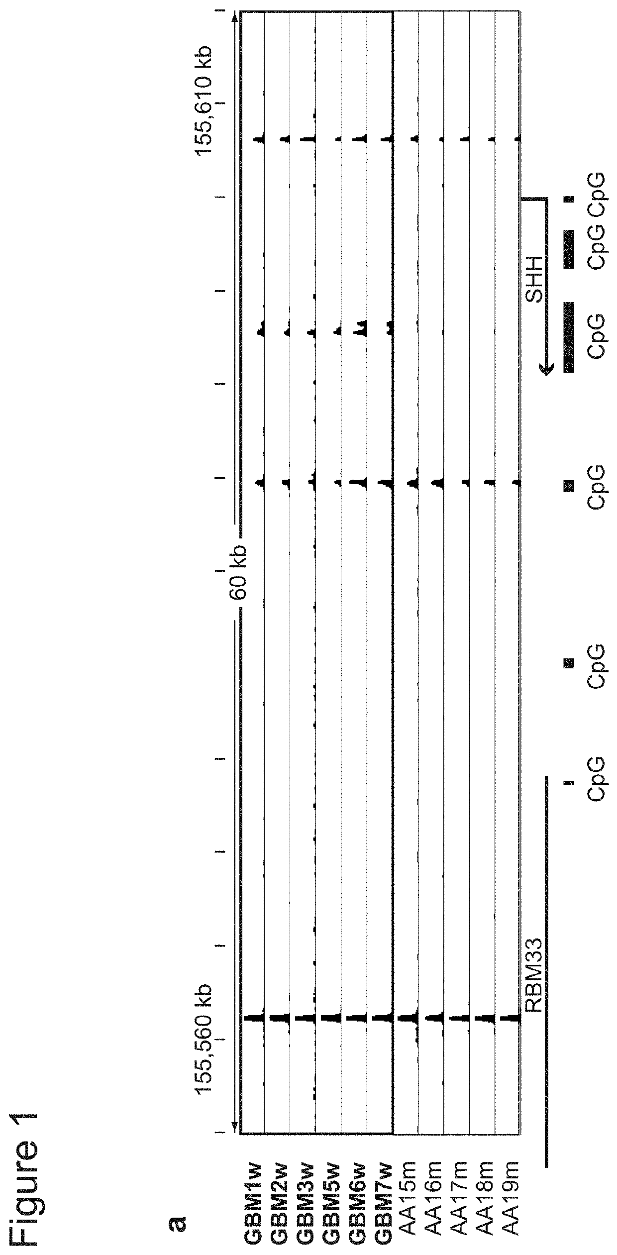 Methods of detecting insulator dysfunction and oncogene activation for screening, diagnosis and treatment of patients in need thereof