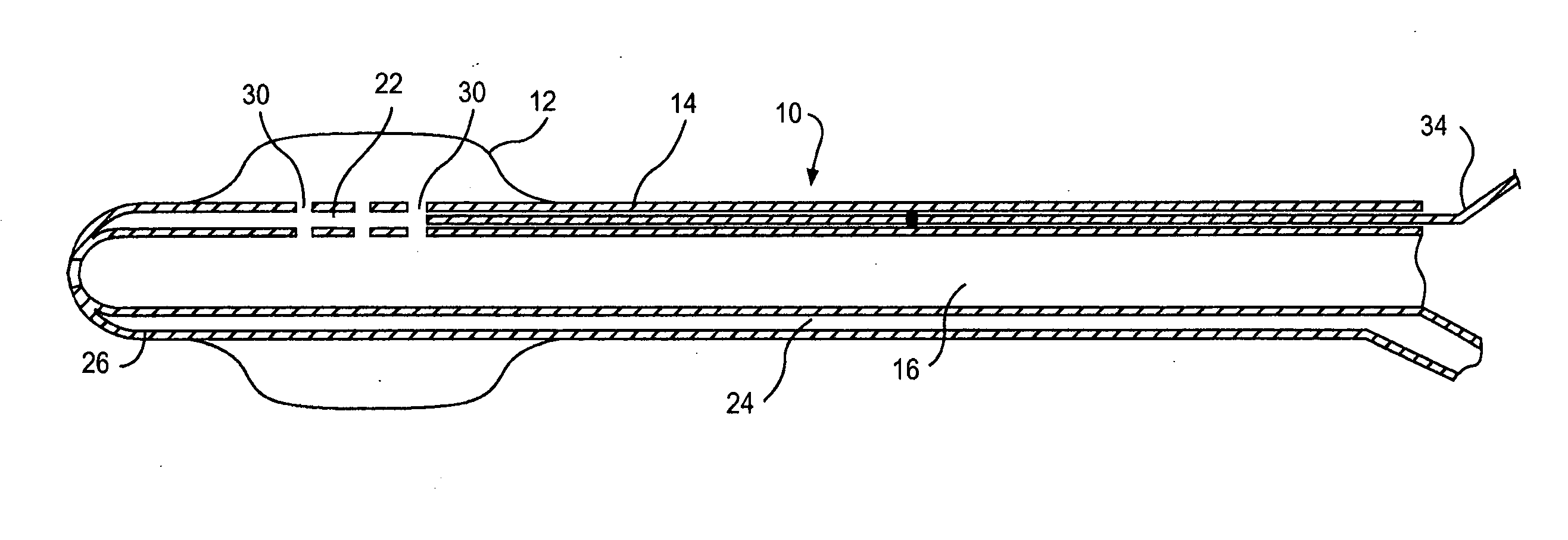 Retrograde cannula having automatically inflatable balloon