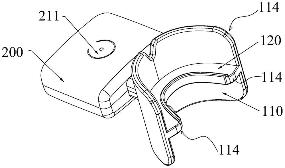 Orthodontic auxiliary device