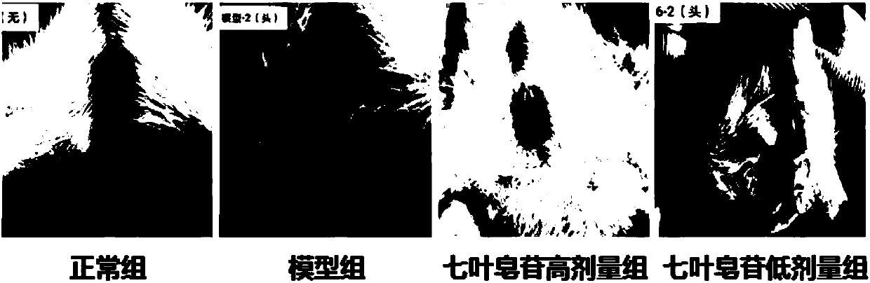 Horse chestnut extract gel, as well as preparation method and application thereof