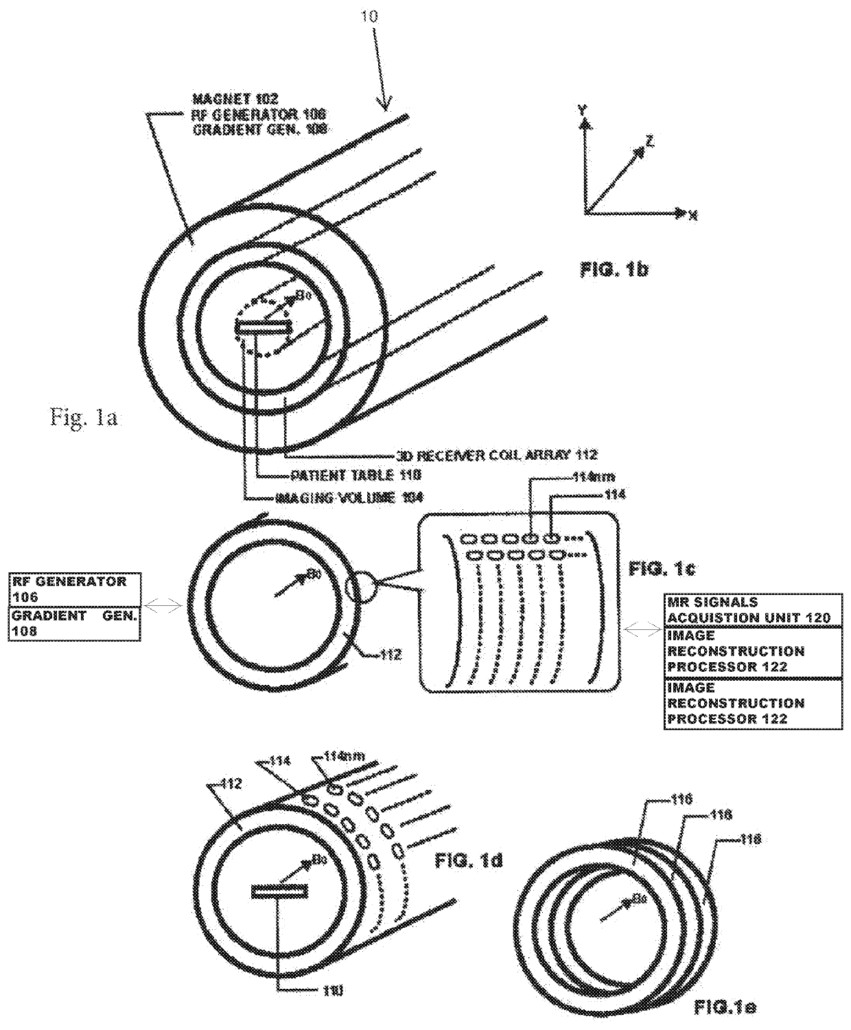 Ultrafast MRI System and Method