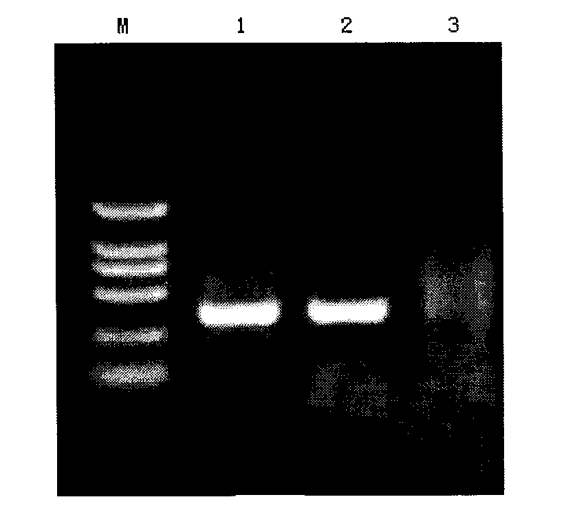 PCR detection kit for zaocys dhumnades