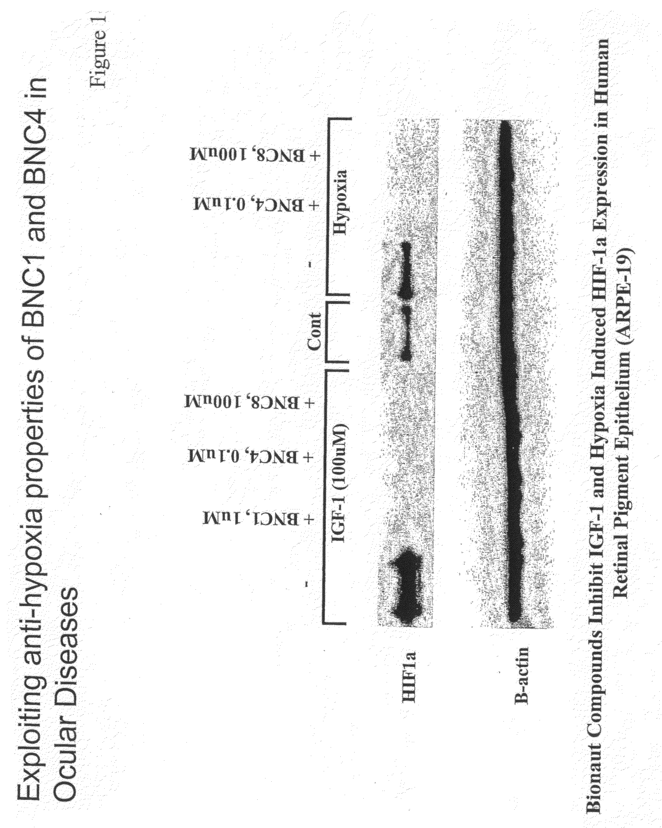 Modulators of Hypoxia Inducible Factor-1 and Related Uses for the Treatment of Ocular Disorders