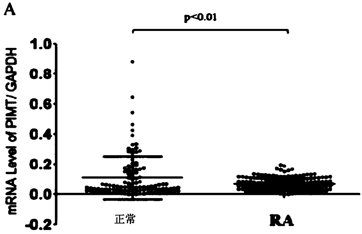 PIMT (protein isoaspartyl-methyltransferase) expression plasmid, amplification primer, construction method and application thereof