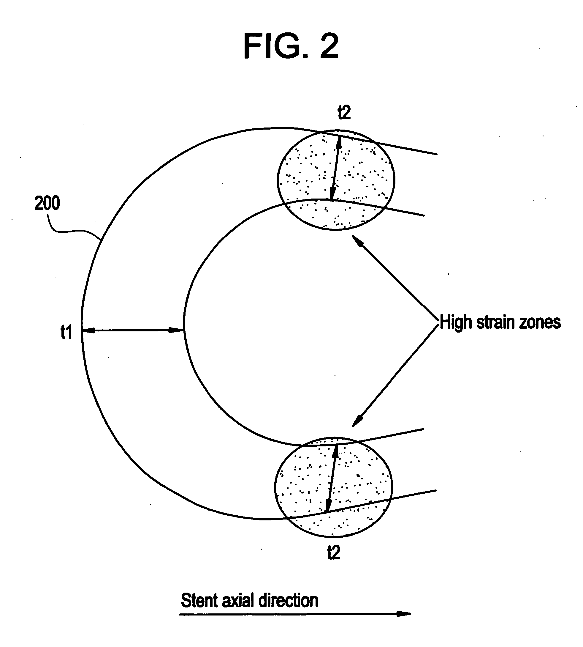 Polymeric stent having modified molecular structures in the flexible connectors and the radial arcs of the hoops