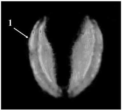 Oil content gene locus specific to tissue part of rapeseed and application thereof