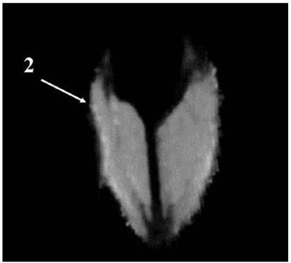 Oil content gene locus specific to tissue part of rapeseed and application thereof