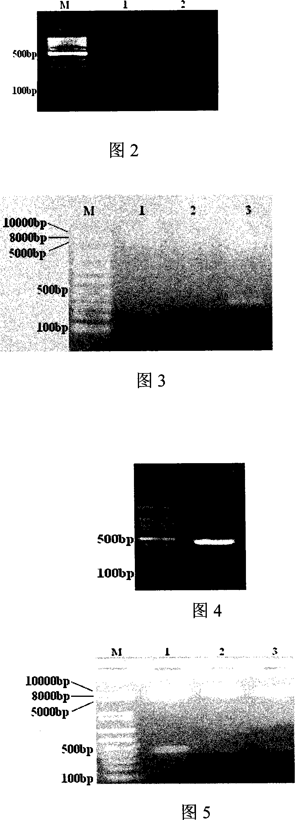 Acute promyelocytic leukemia DNA vaccine PML-RAR alpha-hGM-CSF and preparation and application thereof