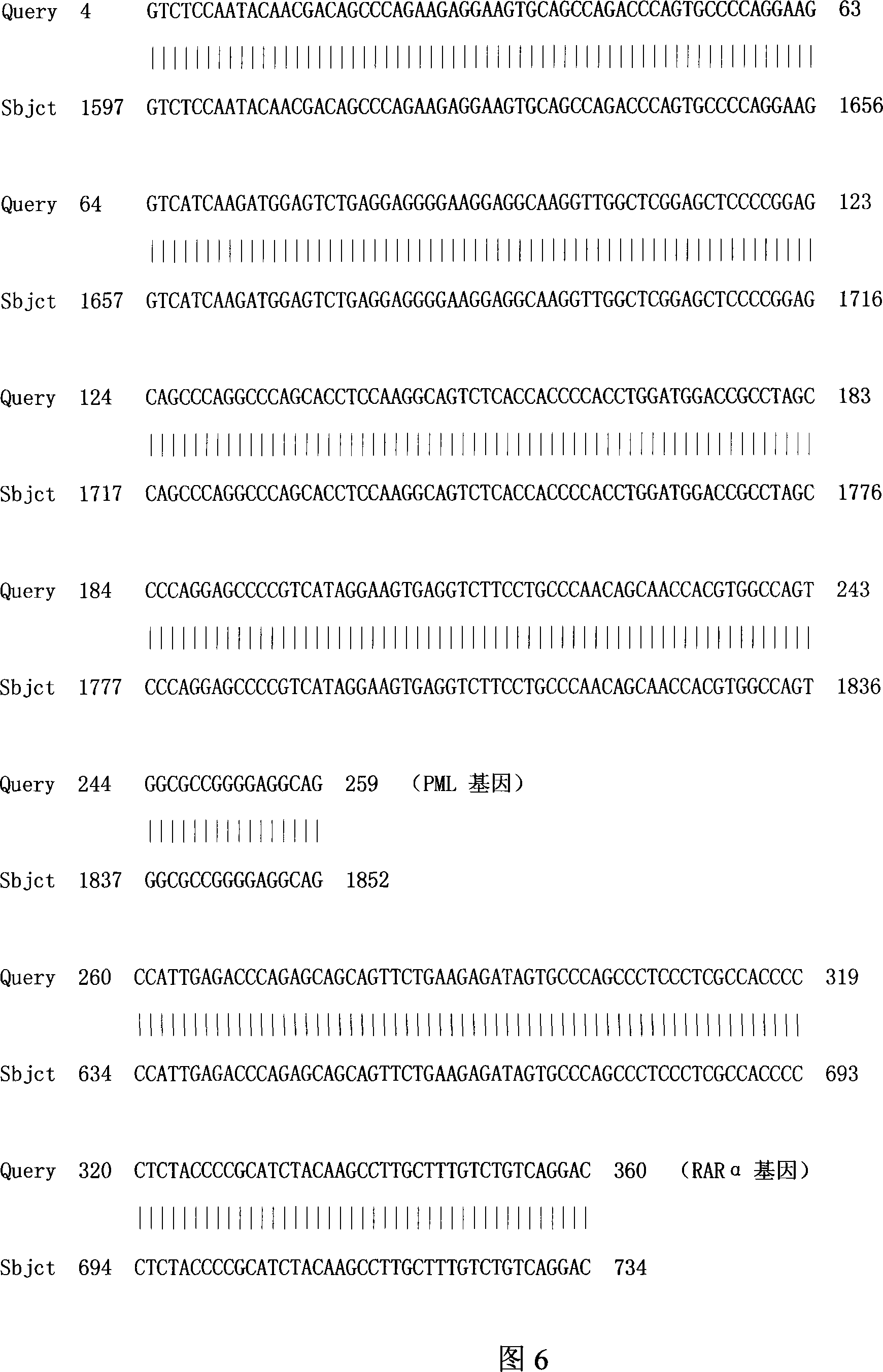 Acute promyelocytic leukemia DNA vaccine PML-RAR alpha-hGM-CSF and preparation and application thereof