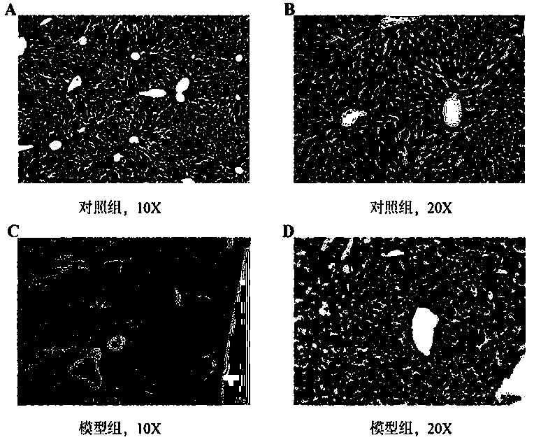 Preparation method of liver cancer animal model