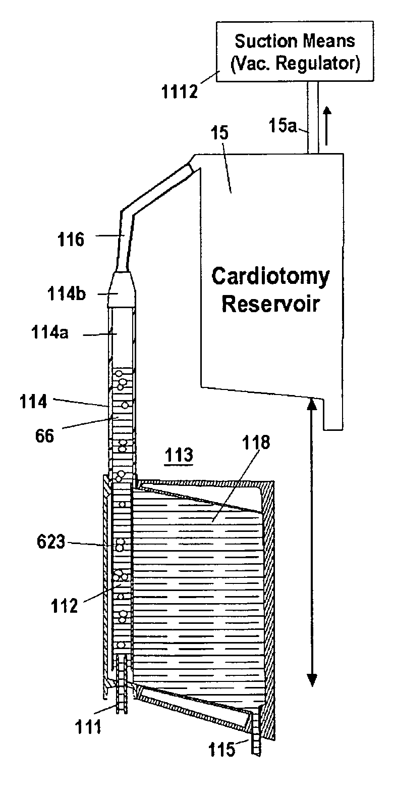 Automated means to remove air from venous blood during CPB