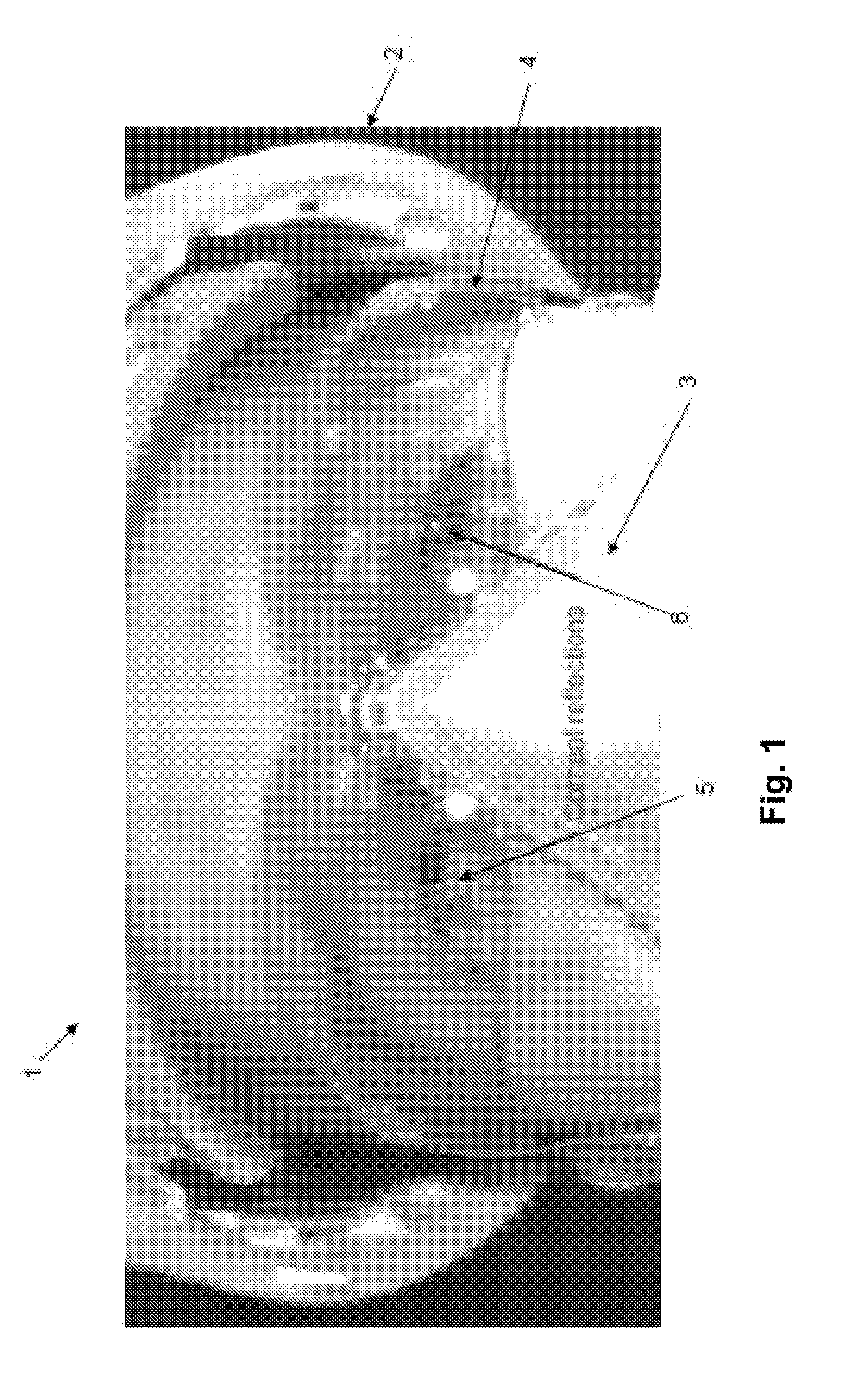 Method and apparatus for eye detection from glints