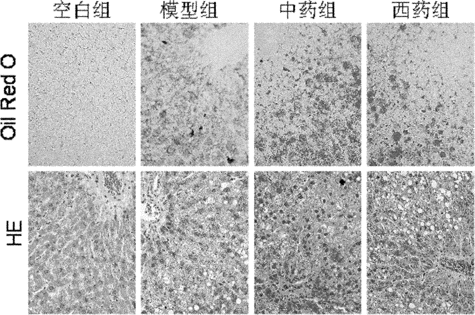 Medicinal composition for preventing or treating nonalcoholic steatohepatitis