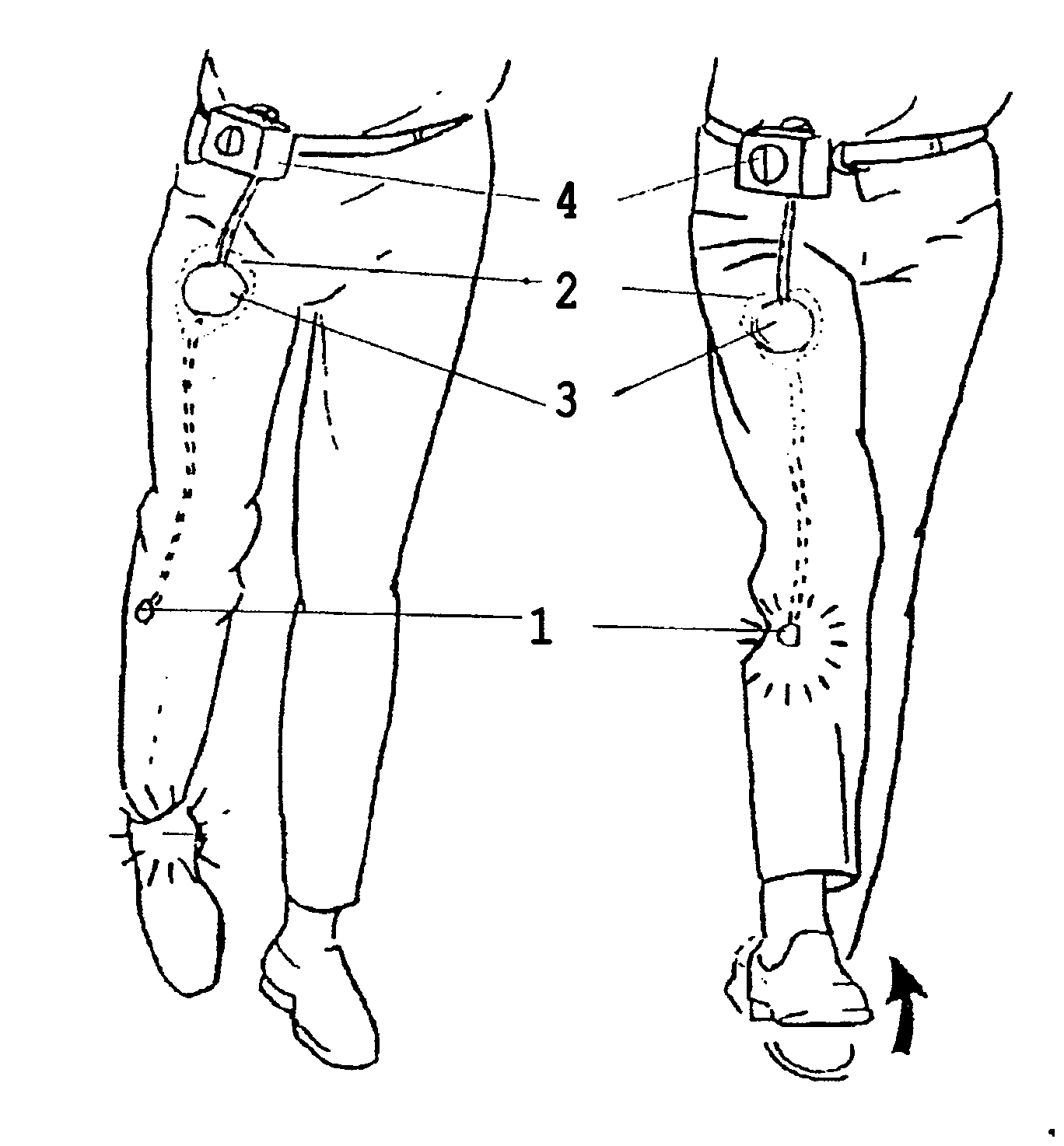 System for electrical stimulation of nerves