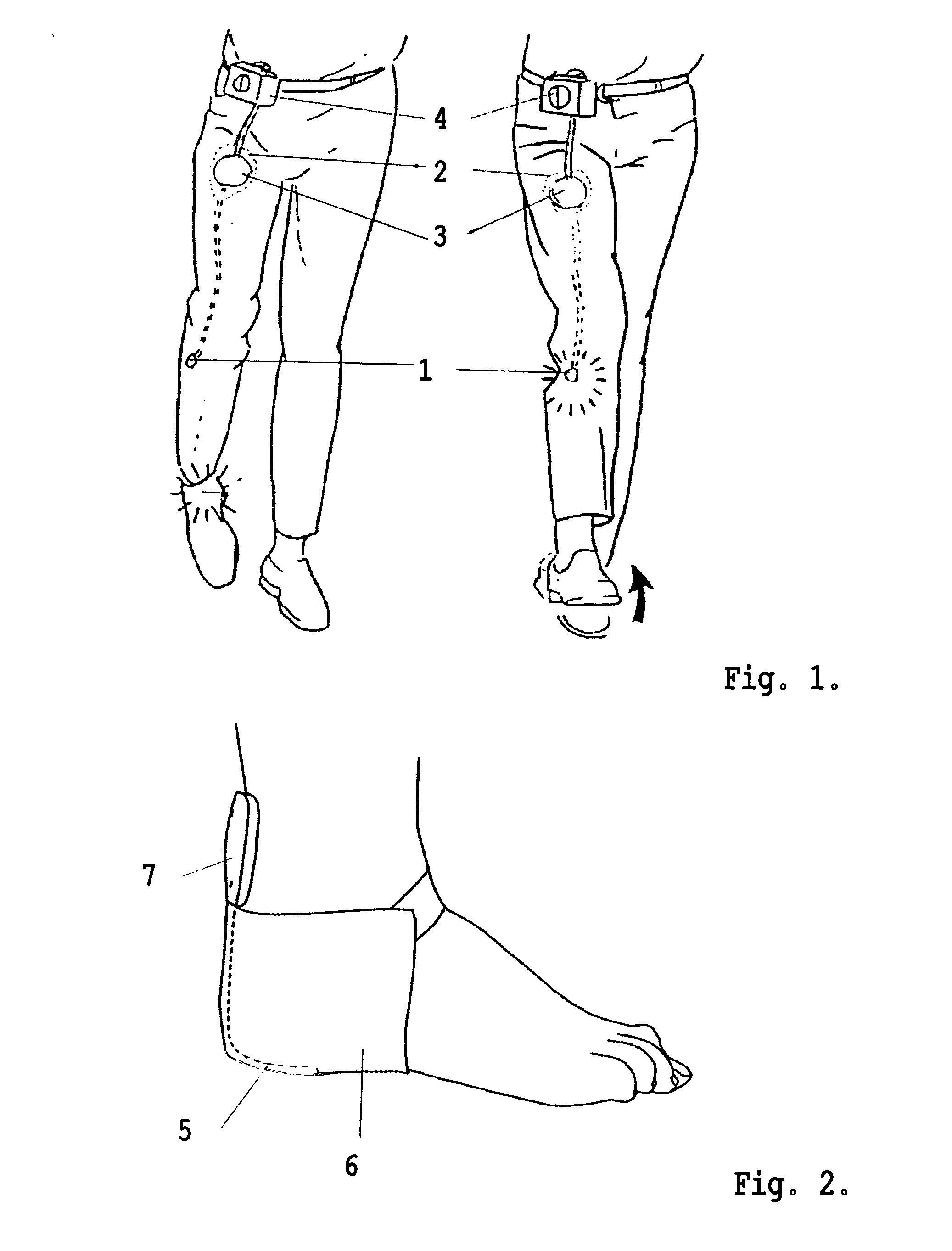 System for electrical stimulation of nerves