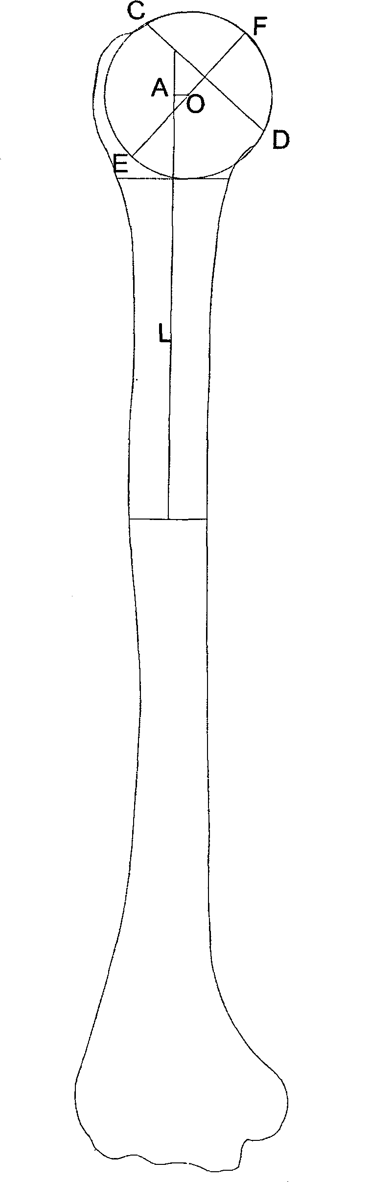 Method for multi-layer spiral CT three-dimensional rebuilding measuring humeral head eccentricity