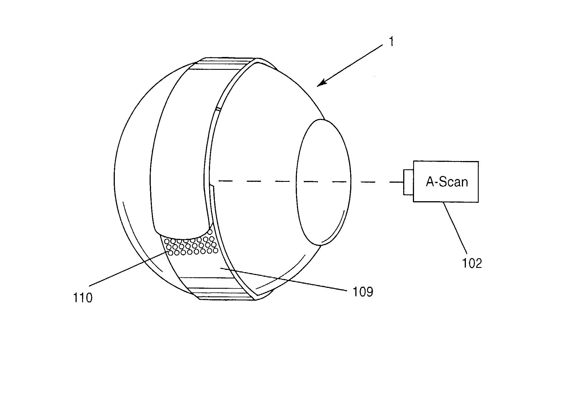 Surgical correction of human eye refractive errors by active composite artificial muscle implants