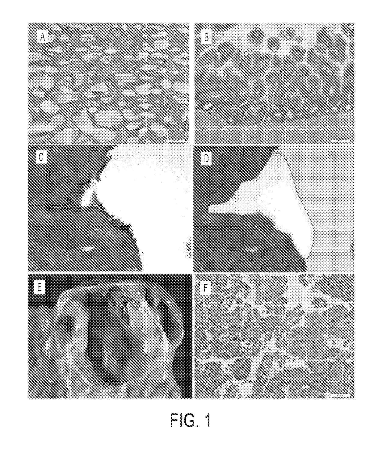 Differential Identification of Pancreatic Cysts