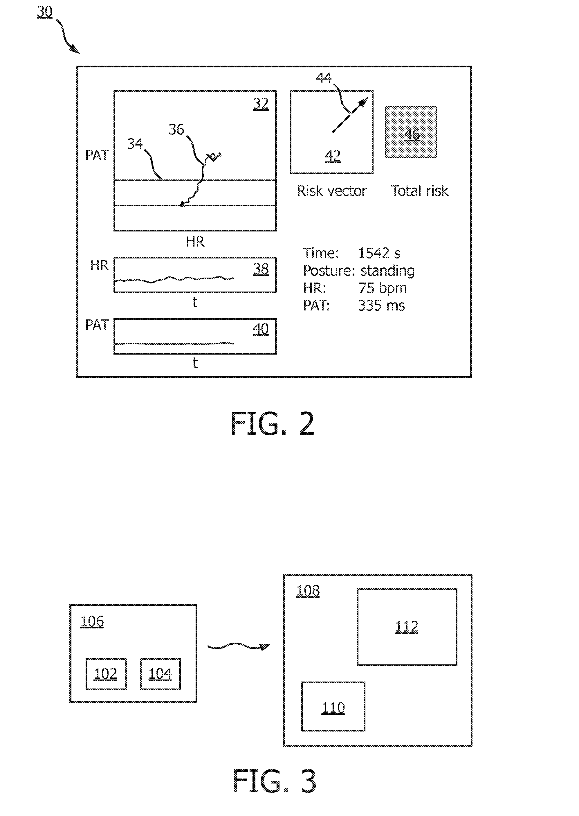 Method and device for detecting a critical hemodynamic event of a patient