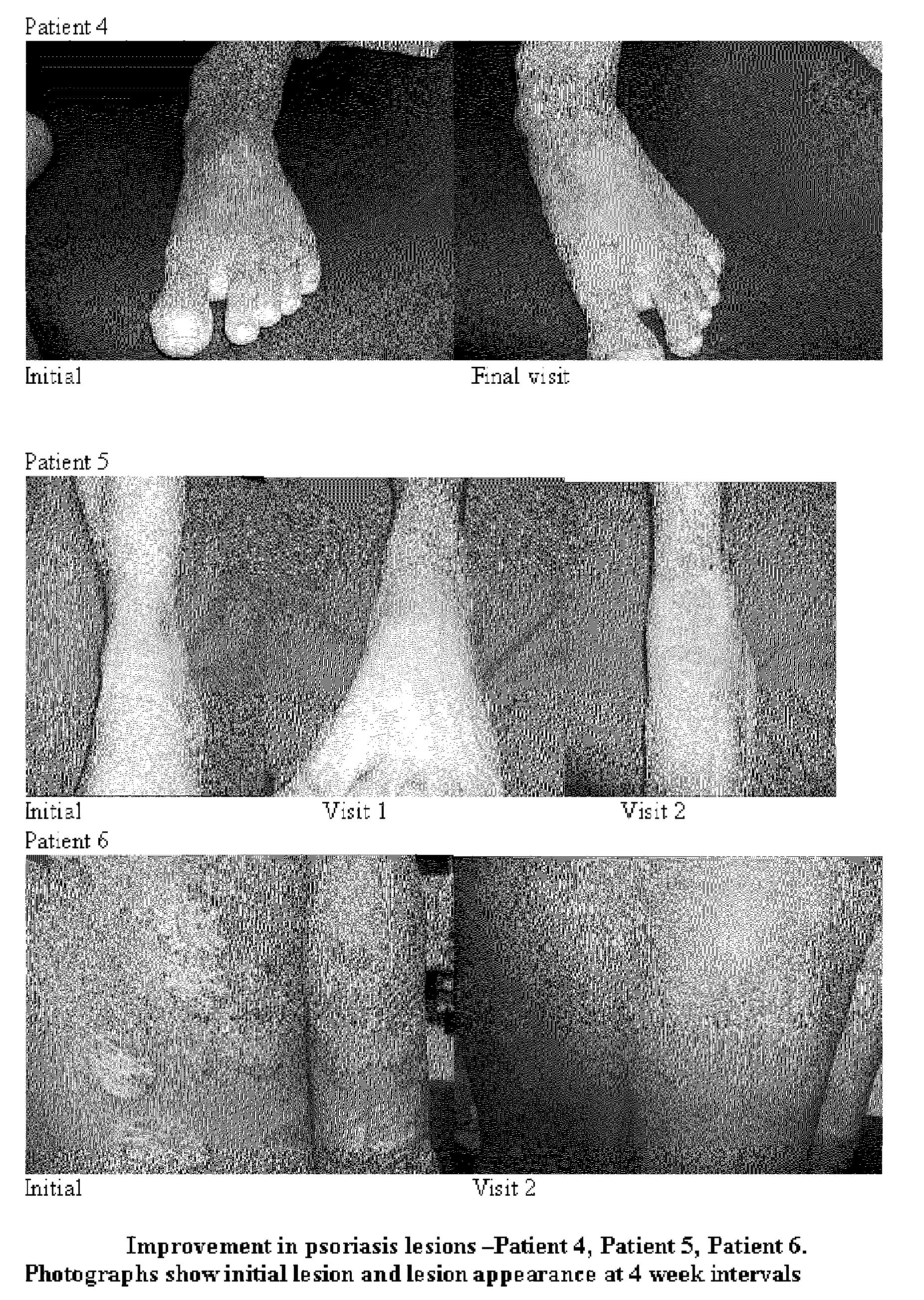 Compositions and methods for the management of hyperproliferative dermatological conditions