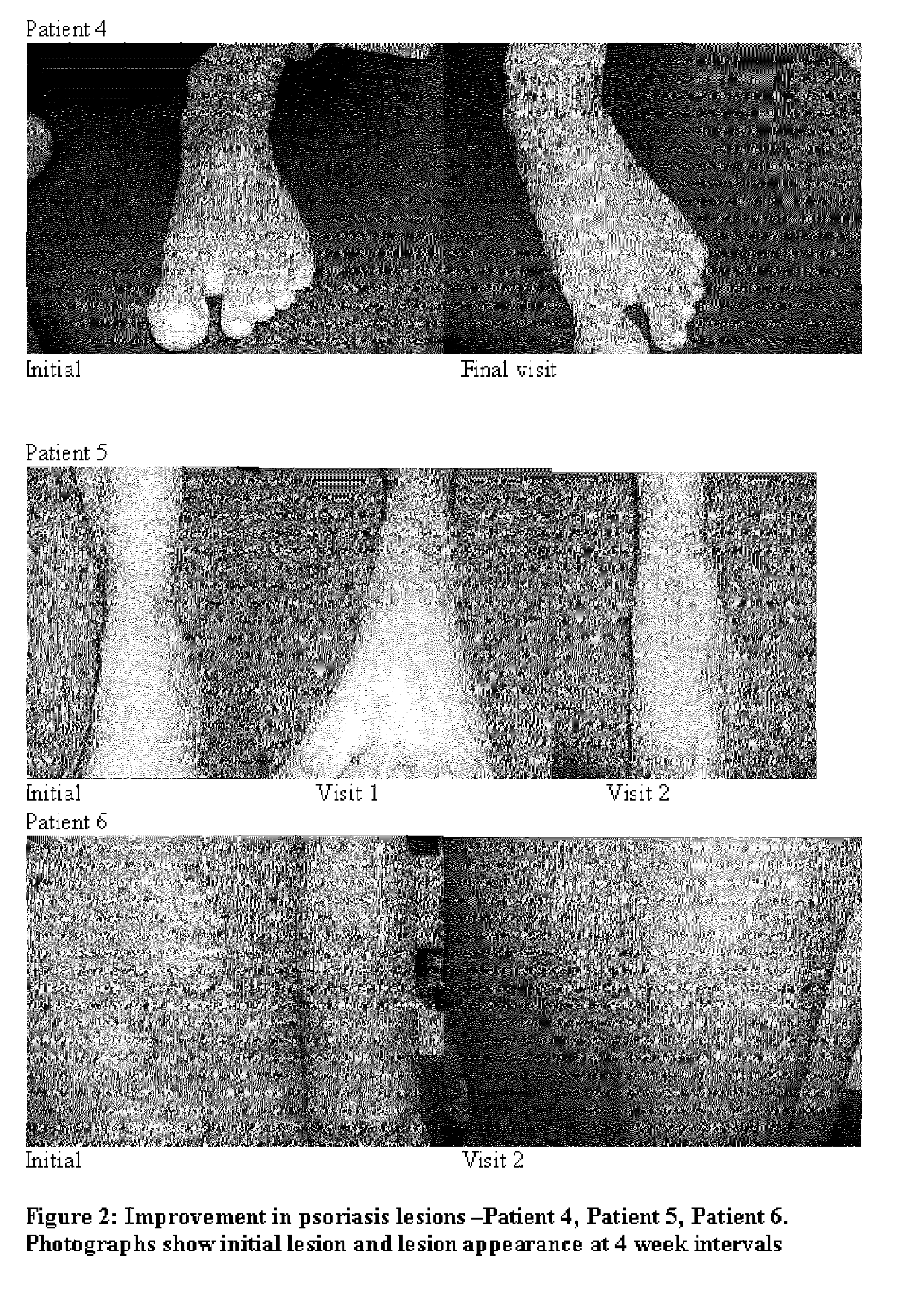 Compositions and methods for the management of hyperproliferative dermatological conditions