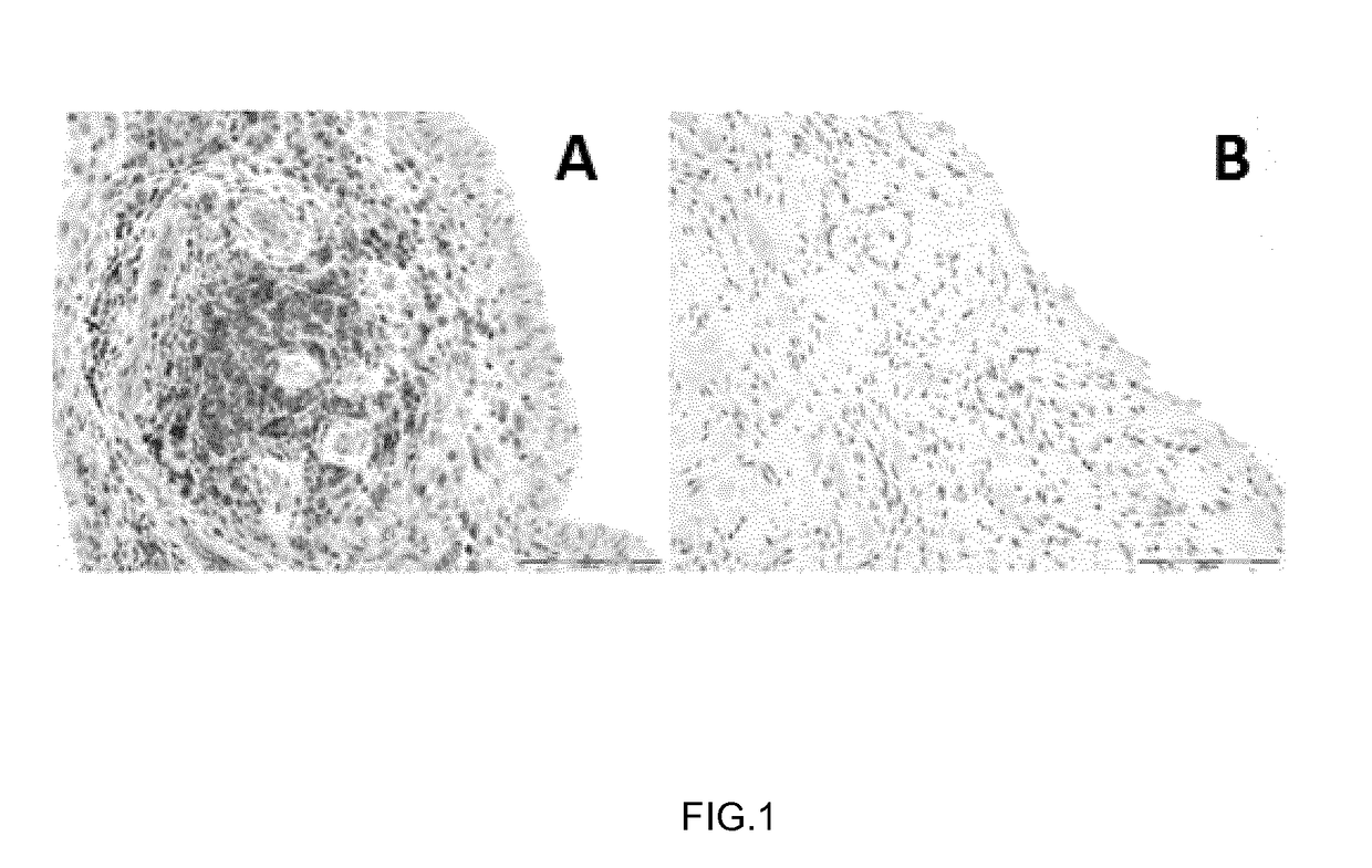 Method to predict the lack of response to Anti-tnf alpha therapies