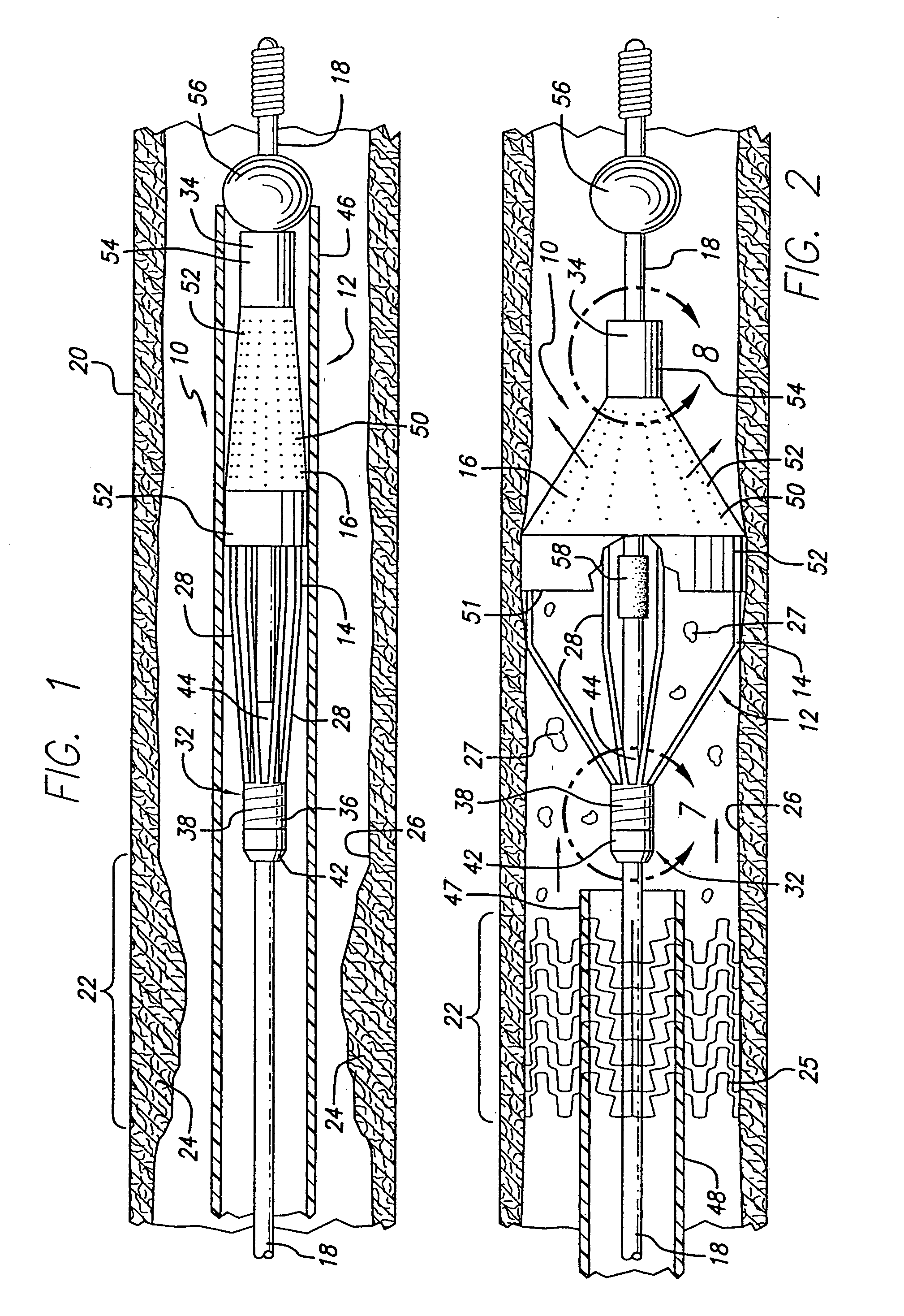 Embolic protection devices