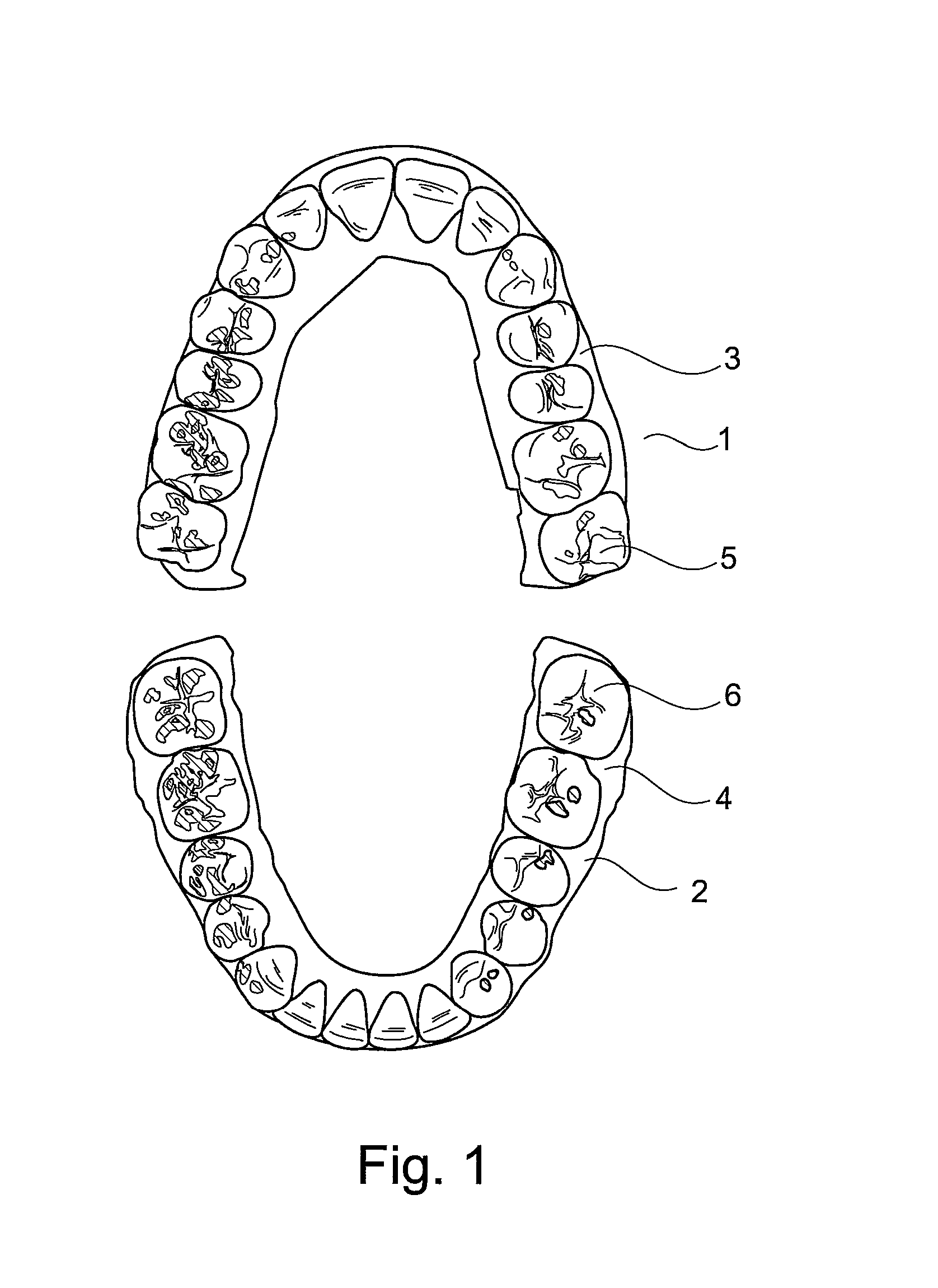 Method for constructing tooth surfaces of a dental prosthesis and for producing dental restorations